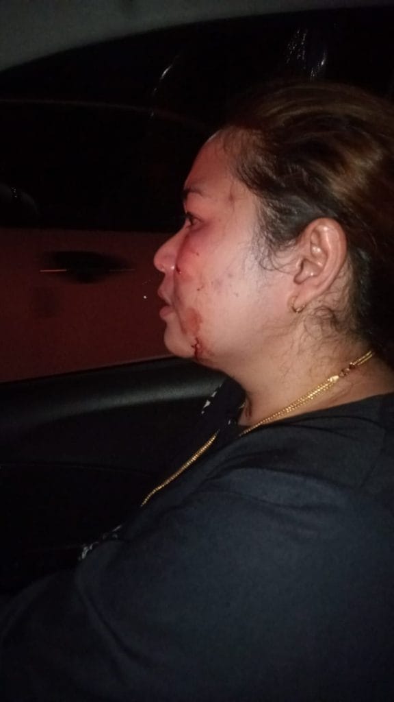 LKBH Makassar Desak Kapolsek Somba Opu Gowa Tahan GE Pelaku Penganiayaan Masih Berkeliaran