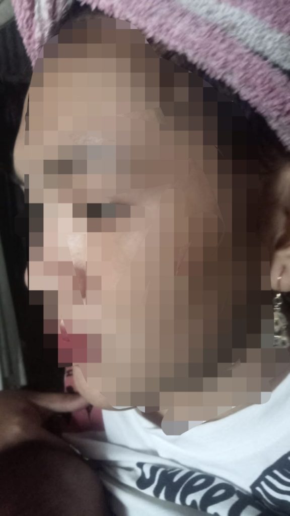 Warga Sampulungan Caddi, Dianiaya, KPMD Lantaran Mempertanyakan Program Bantuan Pemerintah Yang Menjadi Hak’nya