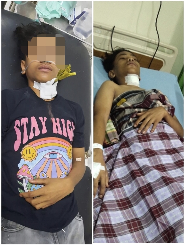 Remaja 16 Thn Jadi Korban Busur Kesasar di Pattunuan Usai Bongkar Tenda Hajatan Warga
